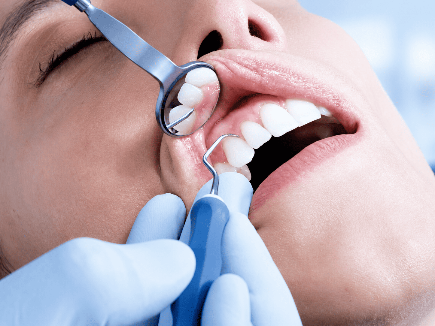 Endodoncia